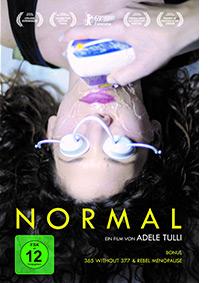 Normal