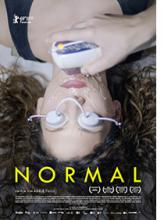 Normal